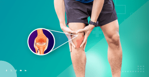 Affordable ACL Surgery in Indore