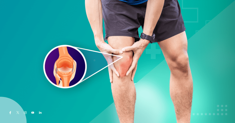 Affordable ACL Surgery in Noida: A Comprehensive Guide
