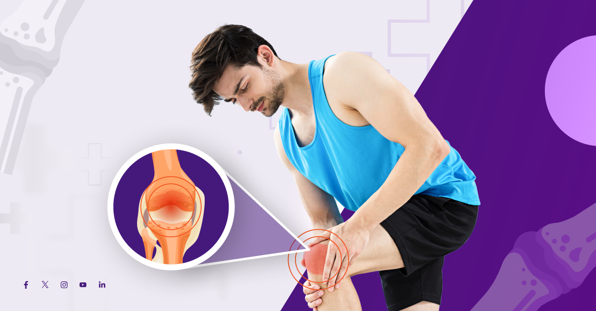 ACL Surgery in Bangalore: Your Complete Guide to Recovery, Cost, and ...